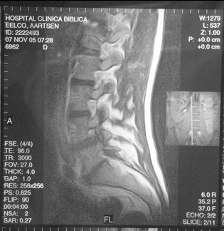 MRI Lengte Slice 2 11