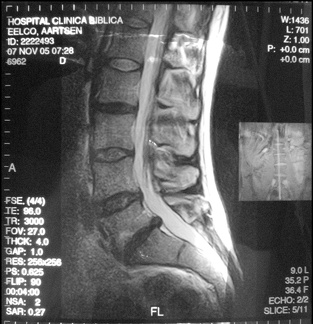 MRI Lengte Slice 5 11