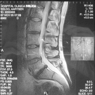 MRI Lengte Slice 5 11 2