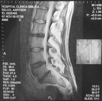 MRI Lengte Slice 7 11