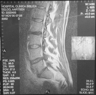 MRI Lengte Slice 8 11